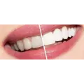 Отбеливатель зубов Miracle Teeth Whitener ∙ Натуральная черная зубная паста для отбеливания зубов