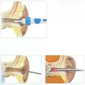 Вухочистка DEOcross C-ears TV One електрична • Компактний прилад DEOcross C-ears TV One з м’якими змінними насадками для догляду за вухами