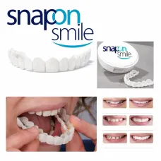 Съемные виниры для зубов Snap On Smile на 2 челюсти • Накладные виниры на верхнюю и нижнюю челюсть для красивой улыбки