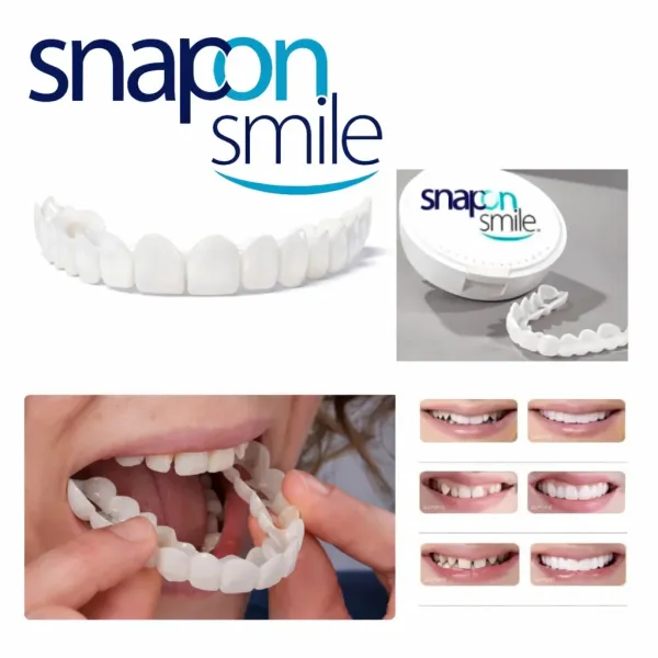 Съемные виниры для зубов Snap On Smile на 2 челюсти • Накладные виниры на верхнюю и нижнюю челюсть для красивой улыбки