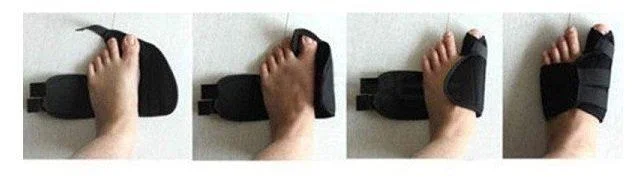 Магнитная вальгусная шина – бандаж для коррекции стопы и косточки Relax Foot Magnet Fix