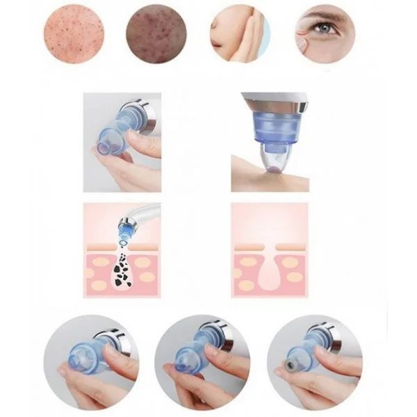 Вакуумний апарат для чищення пор ∙ Апаратна чистка обличчя Derma Suction